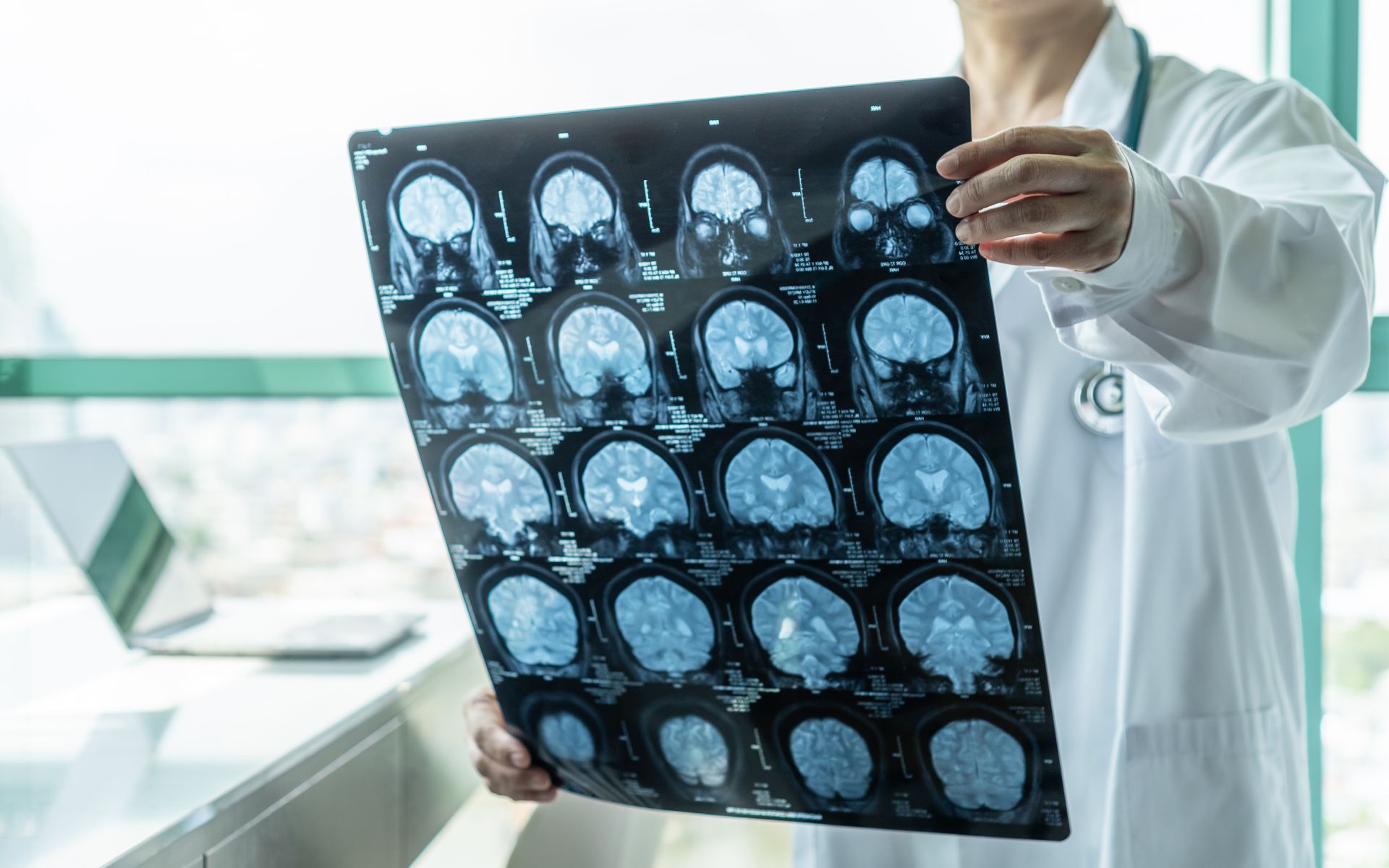 NAC and neurodegenerative diseases - what are the relationships?